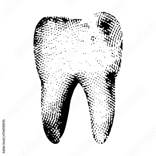 Tooth illustrates decay in dental health