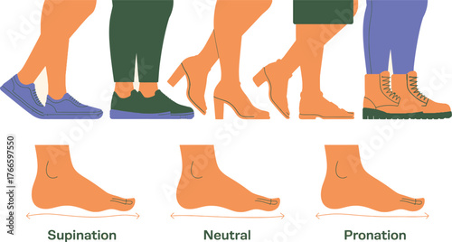 Feet Supination, Neutral, and Pronation Types Wearing Different Shoes, Including Sneakers, Heels, and Boots Illustration