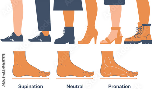 Foot Pronation Types Supination, Neutral, and Pronation Shown with Different Shoe Styles and Foot Shapes