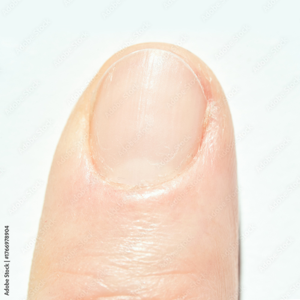Fototapeta premium Close-up of caucasian adult fingernail highlighting cuticle and nail texture.