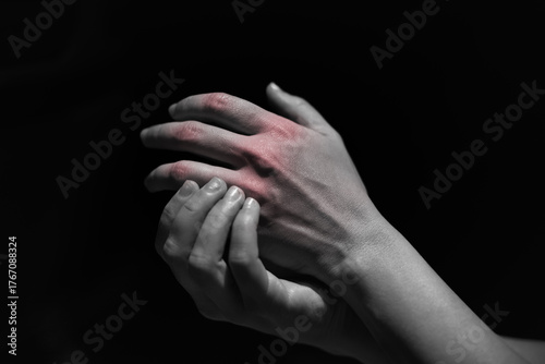 Картината върху платно Close up of woman massage fingers to relive pain, arthritis treatment , gout, rh