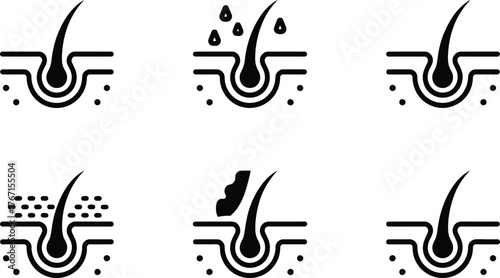 Hair Follicle Health and Treatment Icons