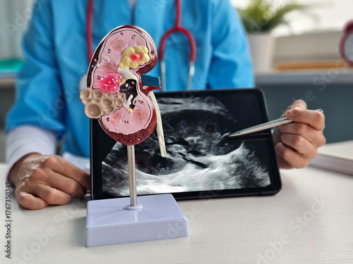 Bilde på lerret Medical professional explains kidney function using a model and tablet display a