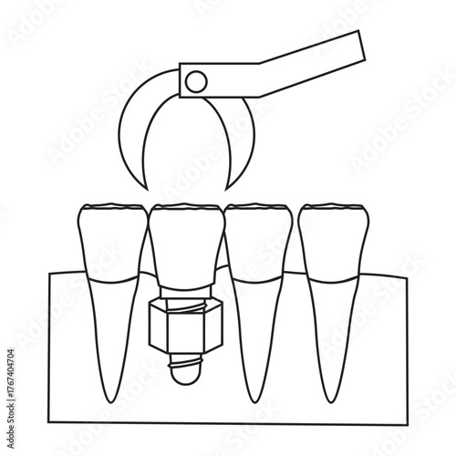 Dental Implant Procedure for Front Teeth glyph icon