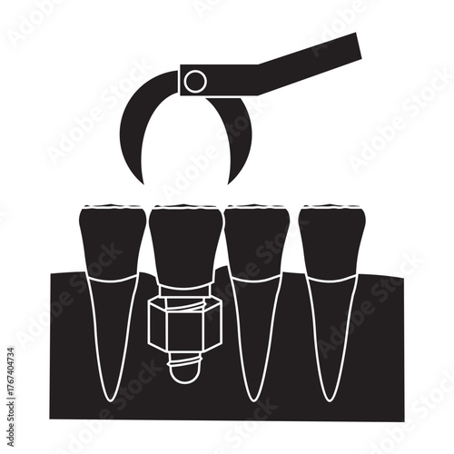 Dental Implant Procedure for Front Teeth glyph icon