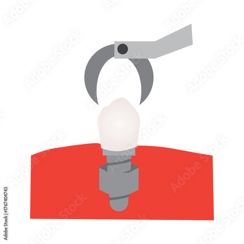Canine Tooth Implant Installation Illustration