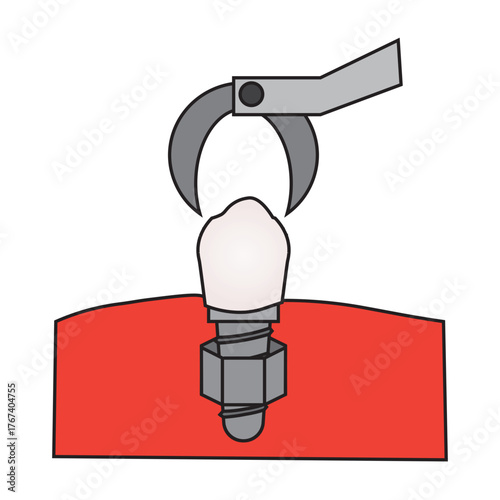 Canine Tooth Implant Installation Illustration