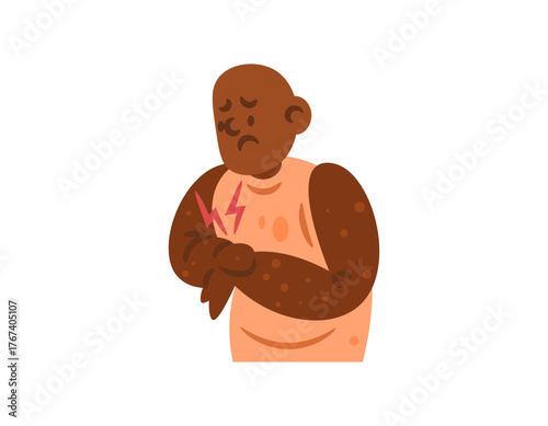Illustration of a bald, black man scratching his itchy hand. Bumpy skin. Skin allergies, skin diseases and health problems. Flat style character design. White background.