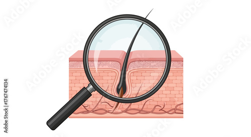 Detailed cutaway of human skin with hair follicle and magnifying glass