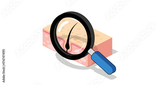 Magnifying glass examining human skin layer diagram in isometric style