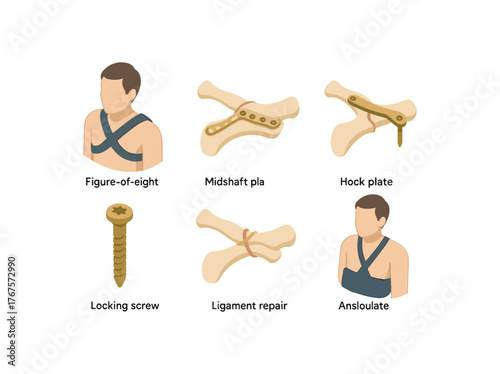 isometric icon items isolated on white background clavicular fracture figure of eight brace clavicular fracture midshaft plate clavicular fracture hook plate clavicular fracture locking