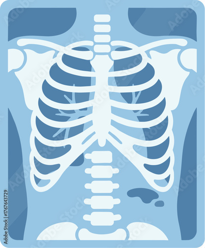 Simple Flat Style Detailed Human Chest X-Ray Illustration