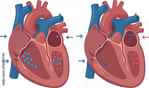 Medical illustration of a human heart, showcasing normal and abnormal conditions.