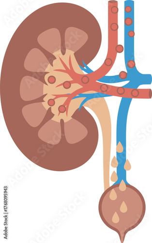 Illustration showing a kidney with kidney stones, ureter, and bladder. Red and blue vessels are also depicted.