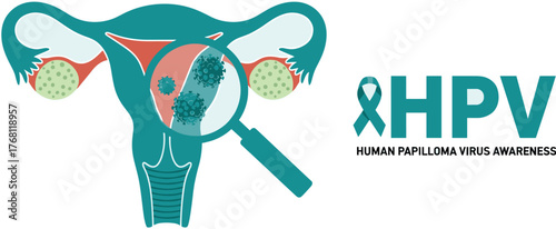 Illustrative Uterus Displaying HPV Infection for Sexual Health Awareness Campaign: Medical Education Visual for Gynecological Health, Promoting Disease Prevention & Vaccination Advocacy, Using Teal Co