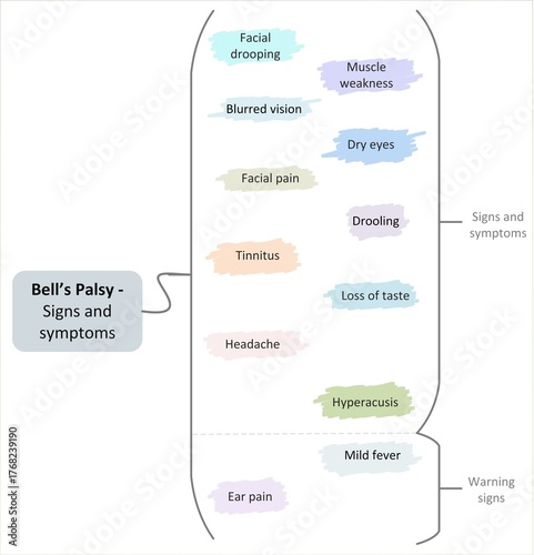 Bell's Palsy - Signs and Symptoms