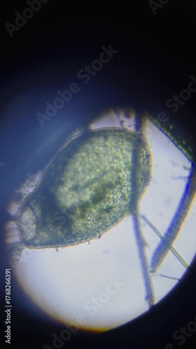 Vertical, extreme close-up shot taken through a microscope, showing a large, transparent, ovoid or teardrop-shaped biological structure, potentially a bladder from an aquatic plant like Utricularia