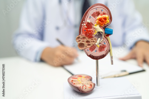 Chronic kidney disease ckd, Doctor hold human model to treat and study in hospital.