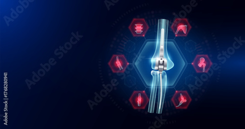 Elbow replacement partial surrounded by arthritis icons. Artificial joint surgery, prosthetic implant integrated into the arm bone. Orthopedic technology medical. Empty space for text. Vector.