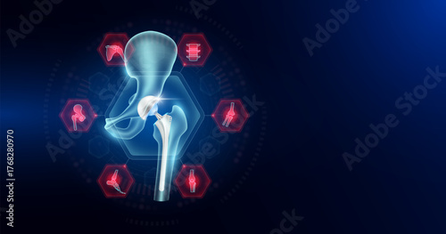 Hip replacement surrounded by arthritis icons. Artificial joint surgery, prosthetic implant integrated into the femur bone. Orthopedic technology medical. Empty space for text. Vector.