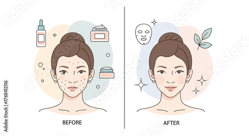 Before and after skincare concept showing woman's face with and without blemishes after skincare
