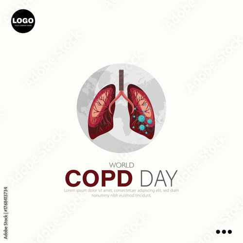 World COPD Day is a global event held annually on the third Wednesday of November.