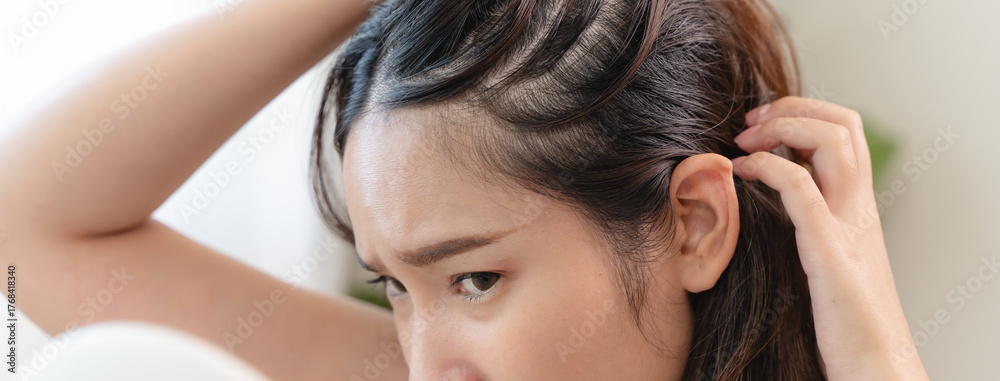 Naklejka premium Young woman scratching her head feeling itch from dermatology problem