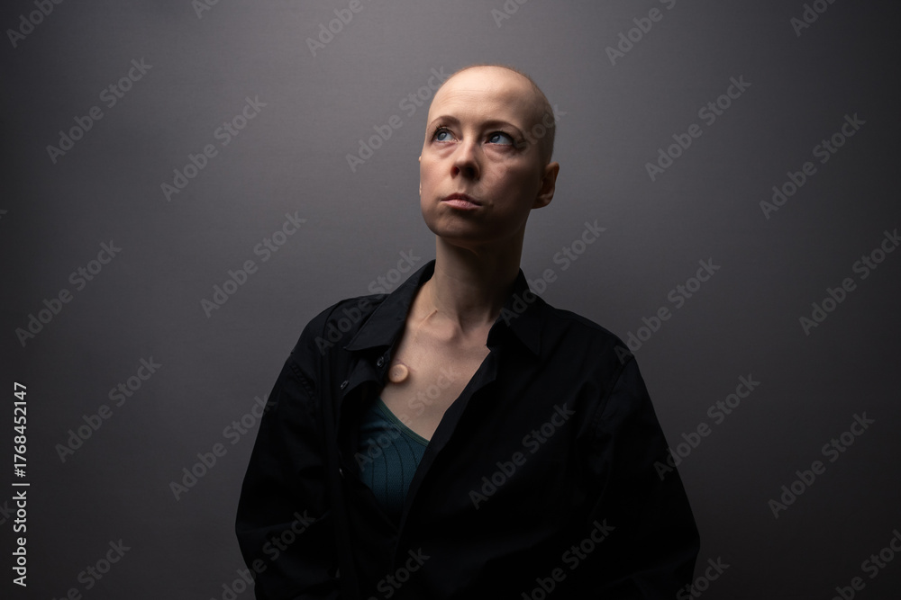 Fototapeta premium Studio portrait of a bald woman after cancer treatment with a medical port visible on her chest, dressed in dark clothing and looking upward thoughtfully