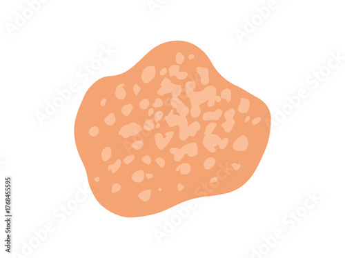 Fungal Tinea Versicolor Illustration