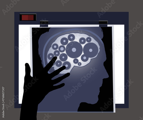 An x-ray of a man's brain shows the cogs, wheels and gears turning inside his skull in a 3-d illustration.
