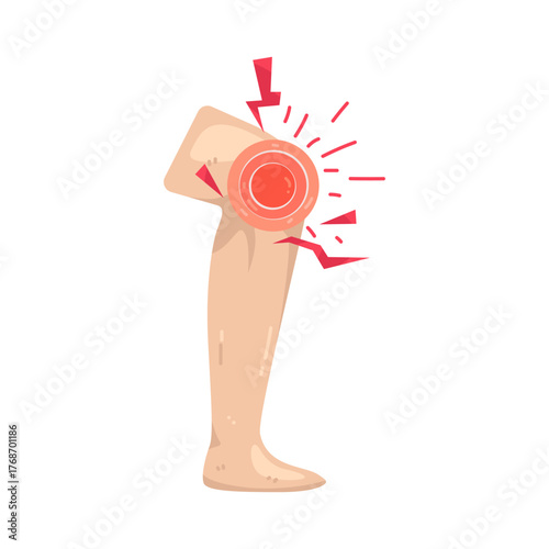 Illustration of Knee Pain 