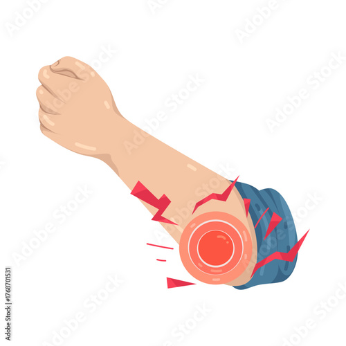 Illustration of Arm with Elbow Pain