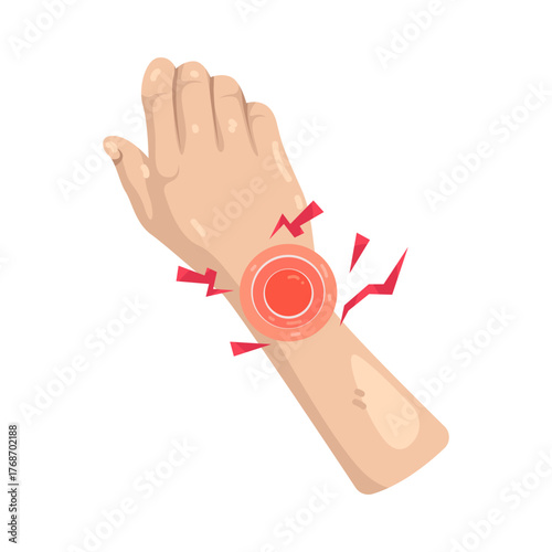 Illustration of Wrist Pain with Red Pain Signals