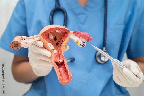 Uterus, doctor holding human anatomy model for study diagnosis and treatment in hospital.