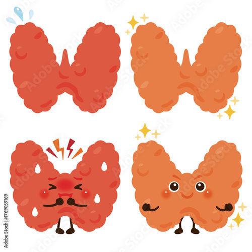働きが過剰になっている甲状腺のキャラクターと元気な甲状腺のキャラクター／Cute Illustration of an Overactive and a Healthy Thyroid Character