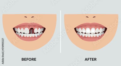 Before and after teeth transformation showing dental health and improved smile