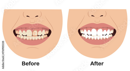 Before and after dental transformation: improving children's oral health through treatment
