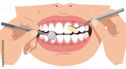 Dentist performing oral checkup with tools in human mouth close-up
