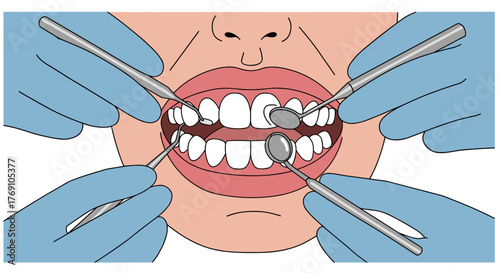 Dental checkup: dentist tools and oral examination close-up