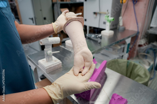 Foto A specialist examines a cast of a limb for further processing in the workshop to manufacture a prosthesis for disability after an injury