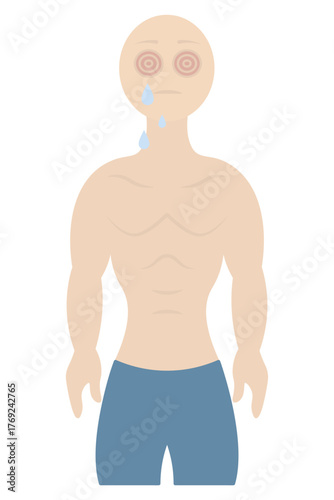 The patient has conjunctivitis. His eyes are red and sore. Color vector illustration. The patient's eyes are watery and dripping. Muscular torso. Isolated on white background. Flat style. Medical them