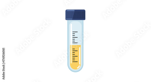 A urine sample is in a test tube with a blue cap and graduations