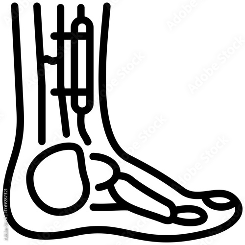 implant icon isolated on white background. vector illustration icon for injury services dan health care