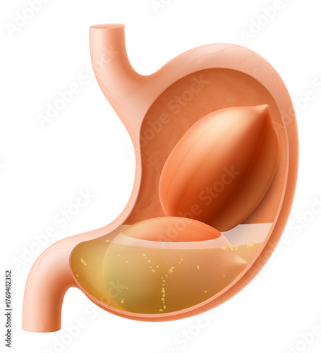 Human Stomach with peanuts. The stomach digests peanut. A stomach filled with healthy and wholesome food. Proper nutrition. Realistic 3d Vector illustration. Food digestion process illustration