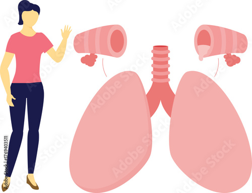 The girl is pointing bronchioles disease