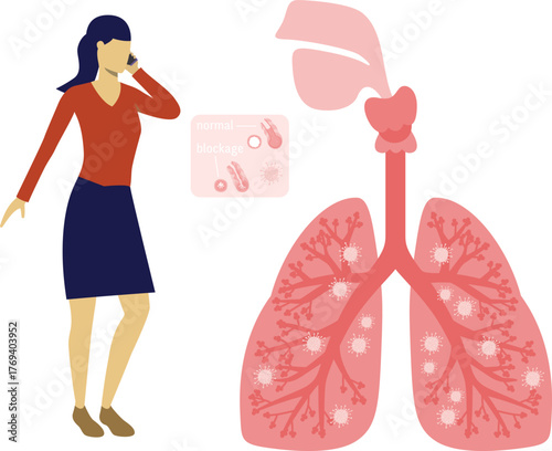Woman talking on mobile lungs infection