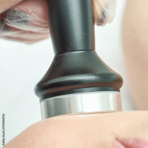 Close-up of skin ultrasound treatment for fat reduction and skin tightening.