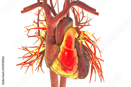 Human heart with right ventricle and pulmonary trunk highlighted in red, 3D illustration