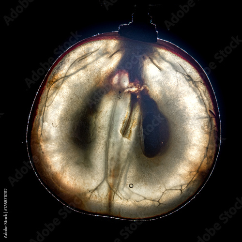 radiographie d'un grain de raisin