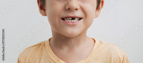 The smile of a little boy without a baby tooth. Panoramic banner. The child's front baby tooth falls out and a new adult tooth grows. Oral care in children.